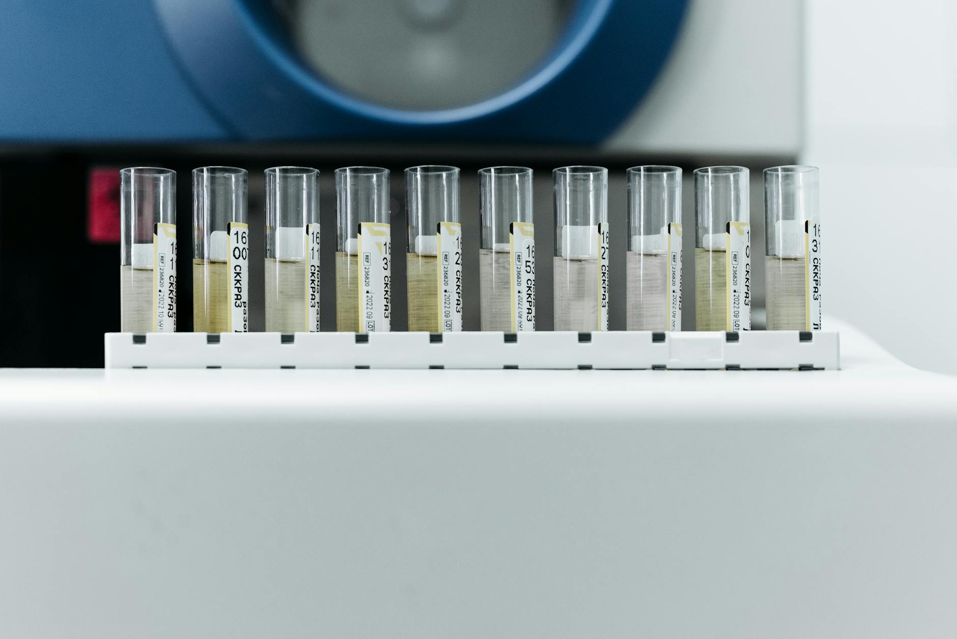 Public health laboratory technician analyzing influenza virus samples