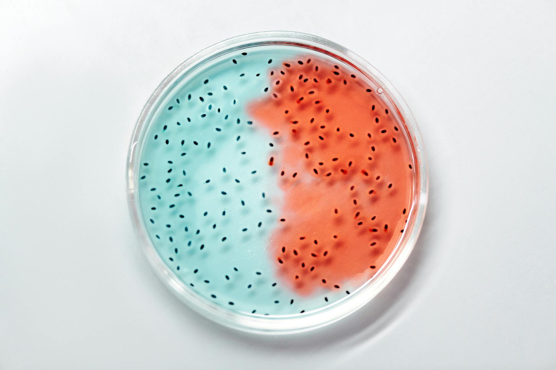 shigellosis bacteria lab culture