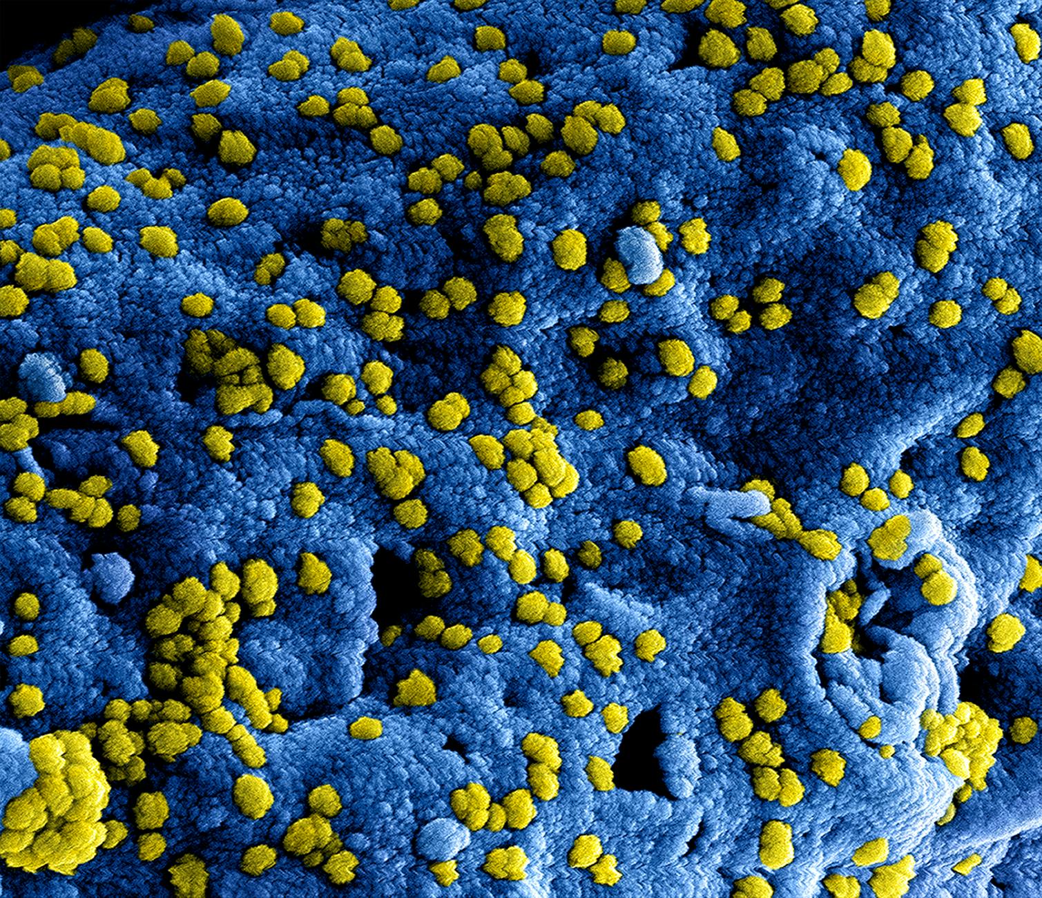 state public health lab - disease surveillance